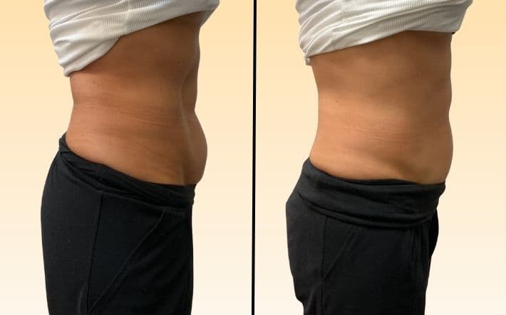 Before and After - 1.75 Inches Lost